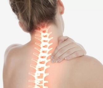 Osteochondroza cervicală