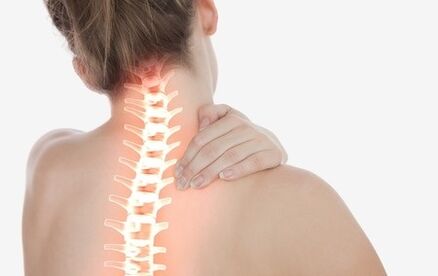 Cum se manifestă osteochondroza coloanei vertebrale cervicale
