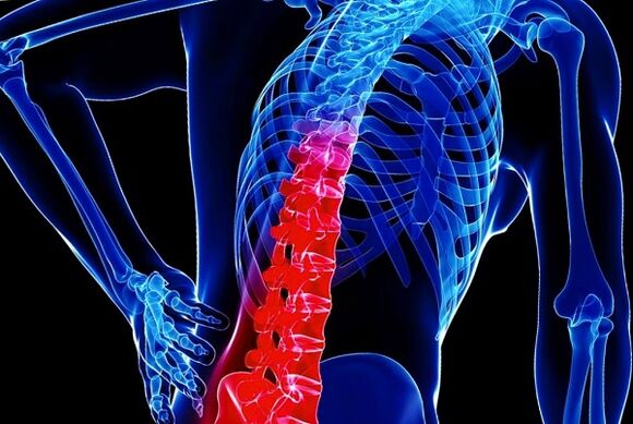 Motivele dezvoltării osteochondrozei toracice