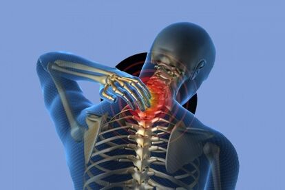 Durere la gât cu osteochondroză