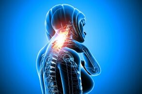 osteochondroză în coloana vertebrală cervicală